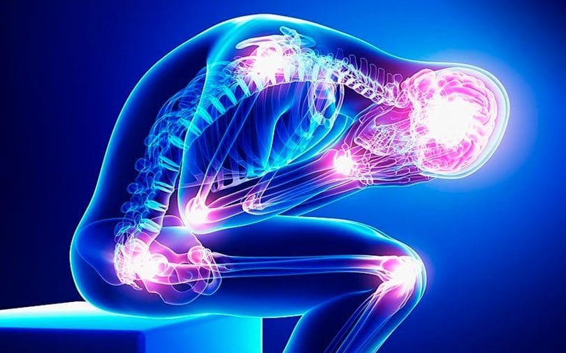 Fibromialgia-810x506-2 O Que é Fibromialgia e Como Buscar Tratamento