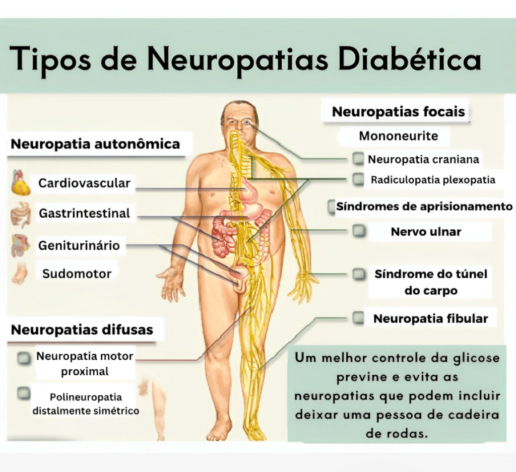 Inserir-um-subtitulo-2-1-1024x937 Neuropatia Diabética: O Que É, Sintomas, Causas e Tratamentos